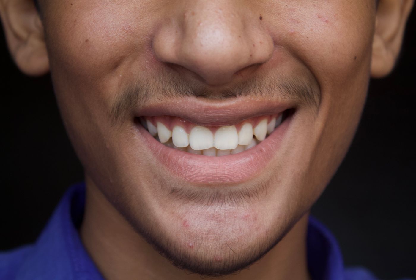 After treatment
